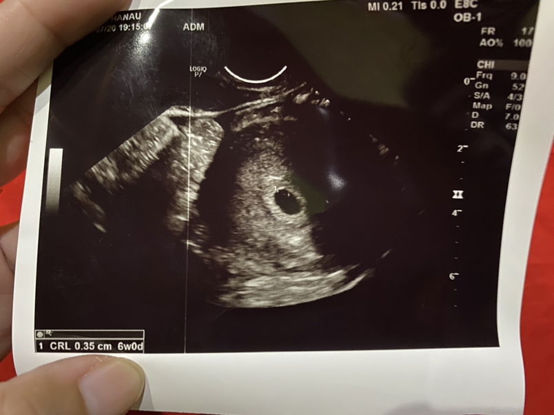 Irma Susiyana profile icon