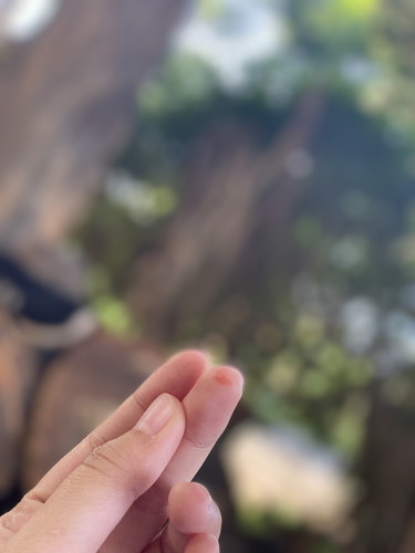 อยากทราบว่ามันเป็นอะไรค่ะ อันตรายมั้ย