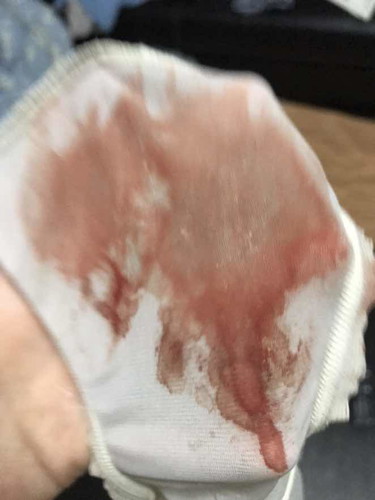 มีเลือดออกหลัง xxx กะคุณสามี