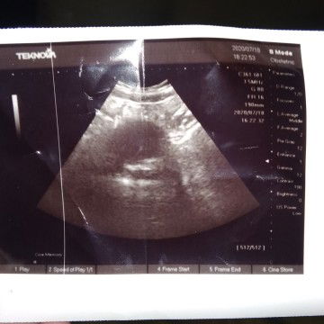 JANIN BELUM TERLIHAT