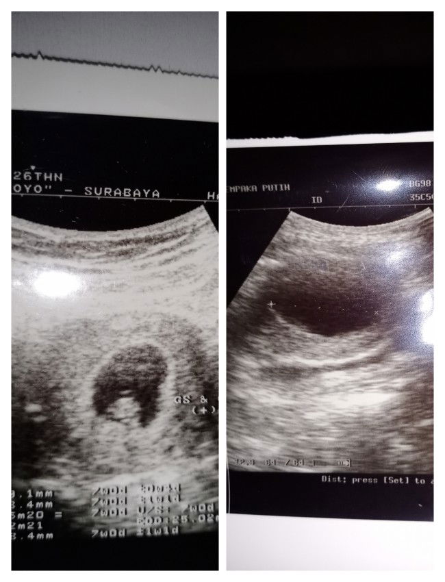 hasilnya sama tidak bun..