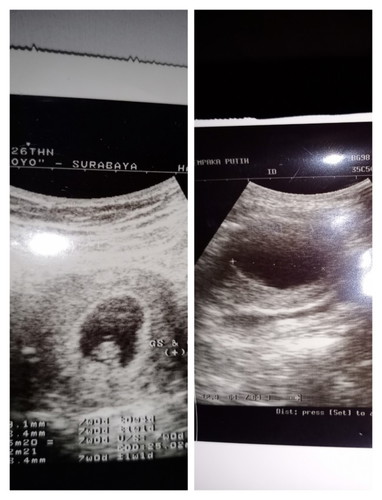 hasilnya sama tidak bun..