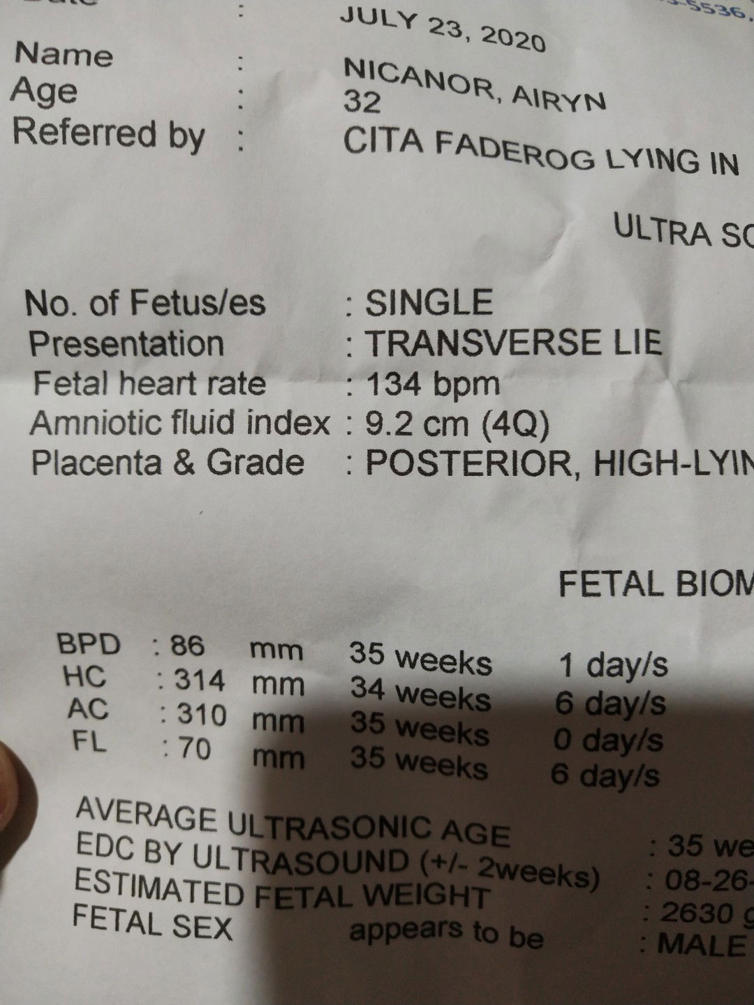 Transverse lie/ Pahalang