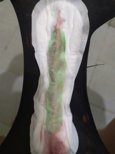 6 weeks bleeding for 6 days