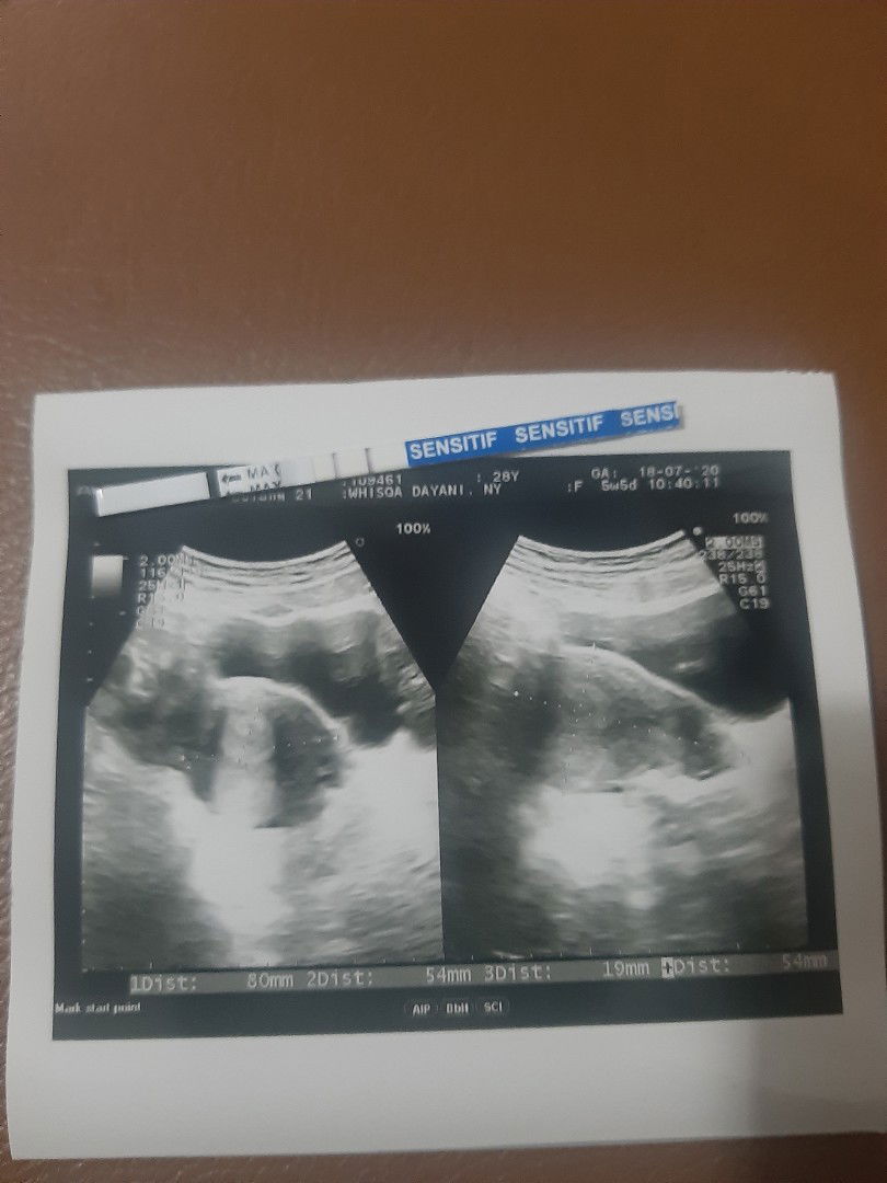 ceu kokom profile icon