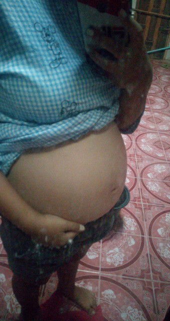 28สัปดาห์