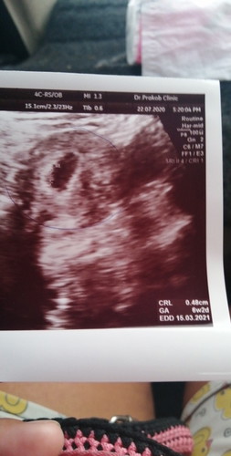 6W2D