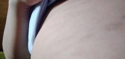 Rashes