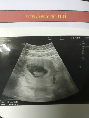 เจอหัวใจลูก
