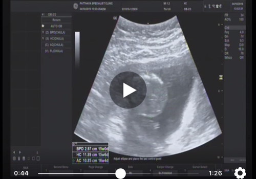 สงสัยคะ