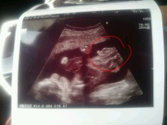 โชว์รูปลูกชายกันหน่อยค่ะแม่ๆ