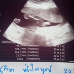 ชุติมา หรั่งไพบูลย์ profile icon