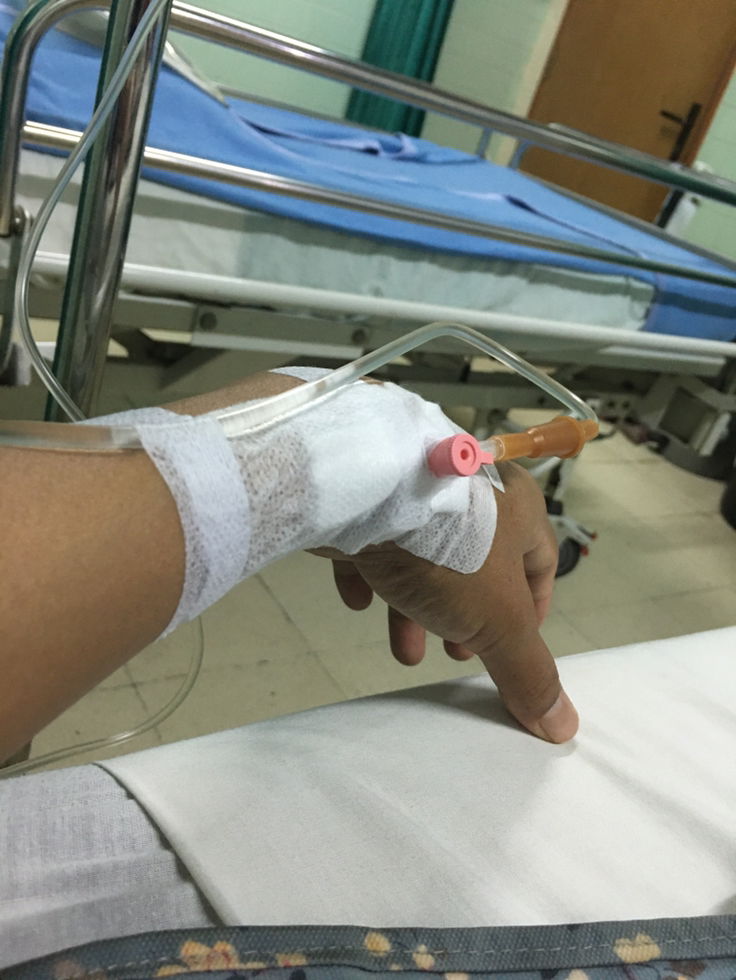 41 wk ketuban berkurang . ?