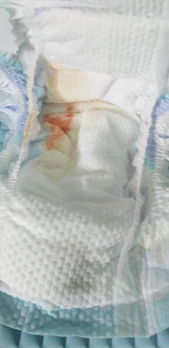 worry pipis si dede :(