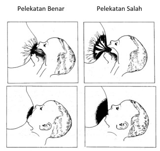 pelekatan dan posisu saat nyusu