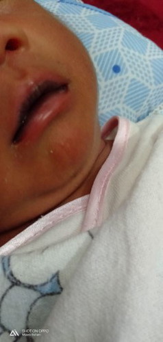 Bibir hitam