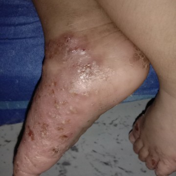 skin