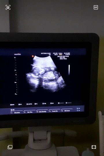 Omega Naka profile icon