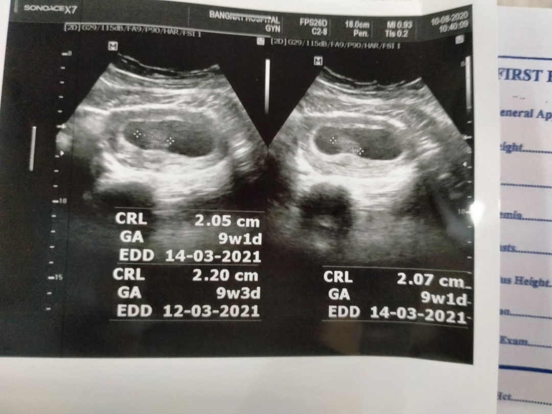 เอวา profile icon