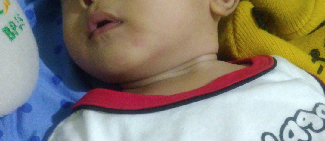 merah2 disekitar mulut bekas makanan