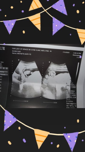 15 weeks pregnant