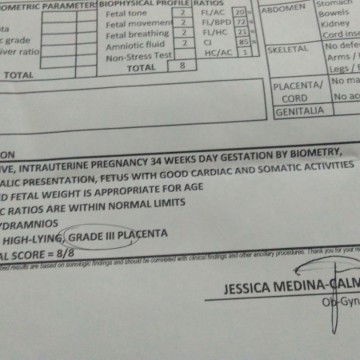 Need Help mga momsh 🙂