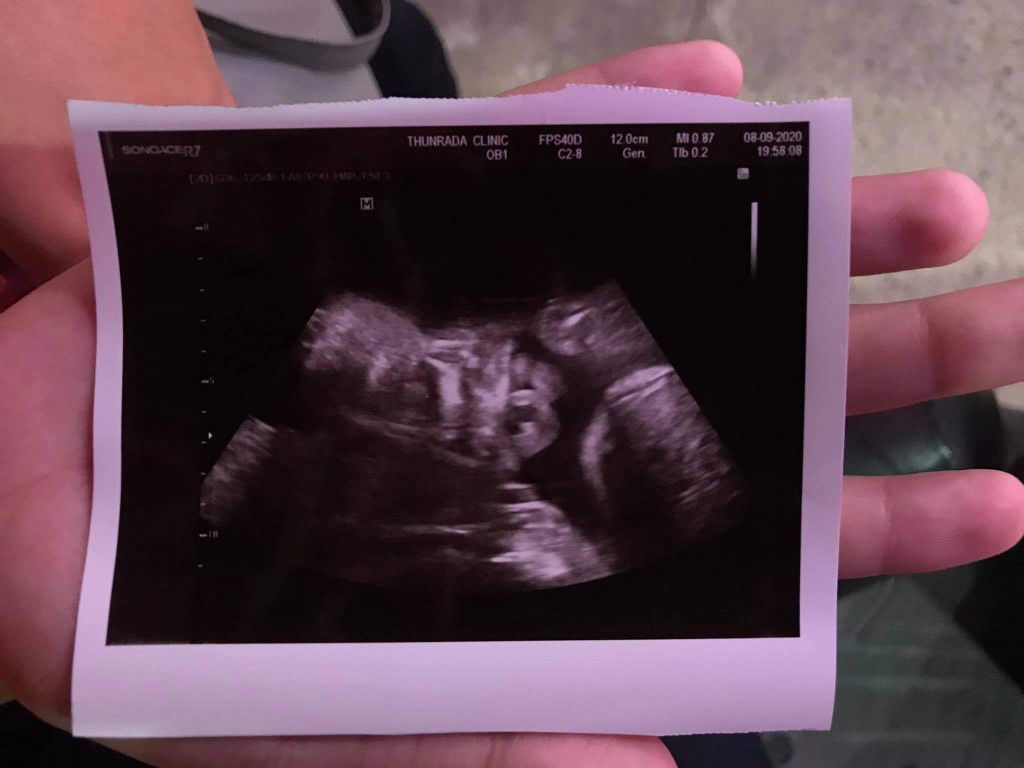 ณิชาภัทร ผ่านเมือง profile icon