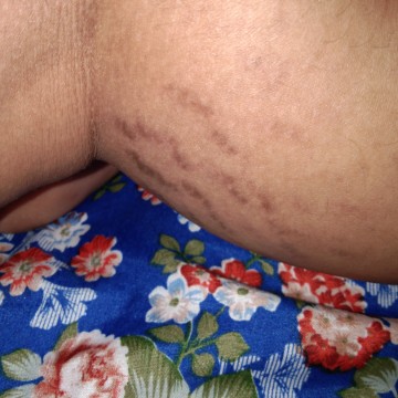 Muncul Guratan