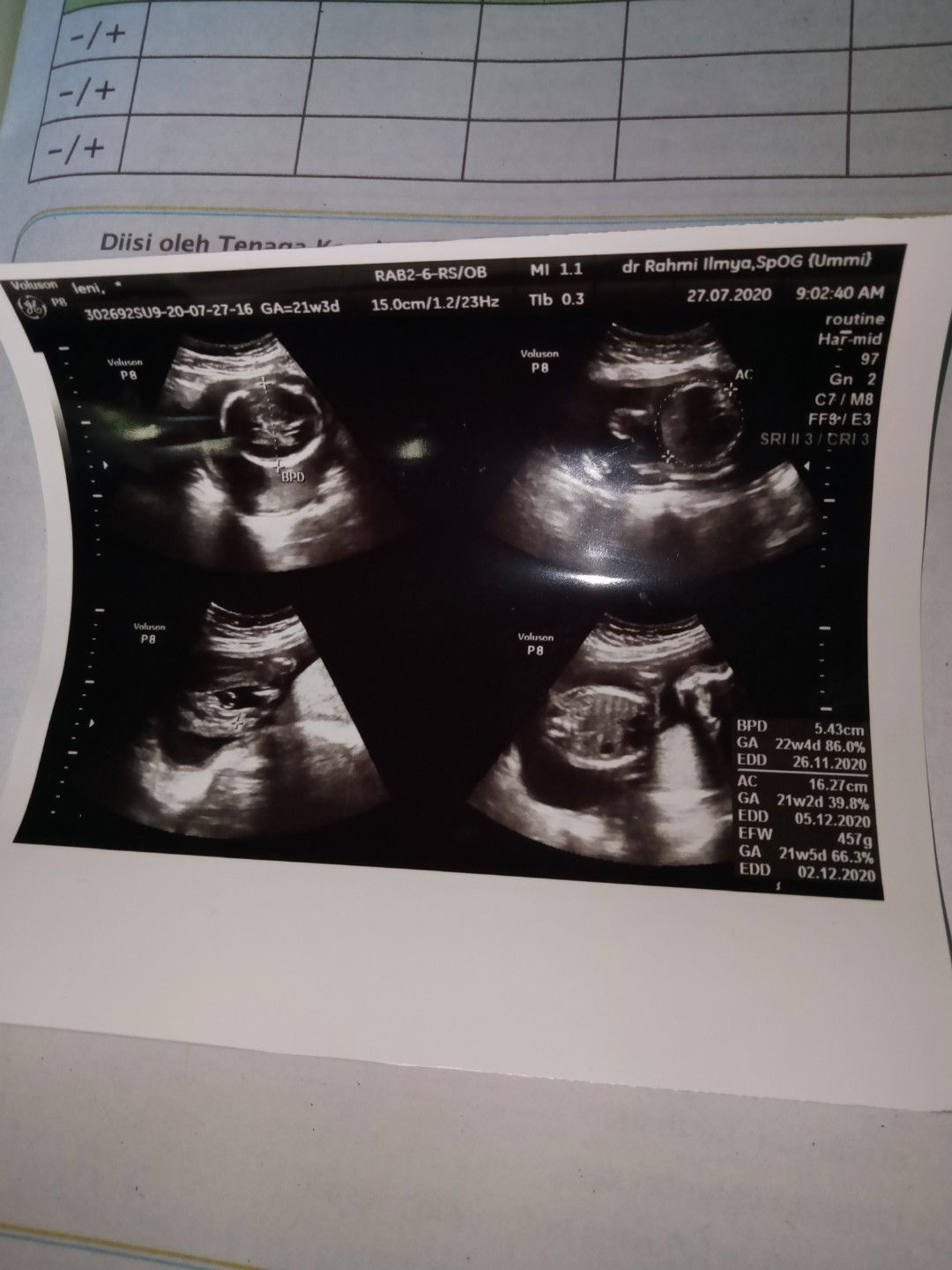 Arti Tulisan dalam usg