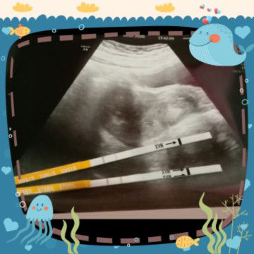 kehamilan yang pertama