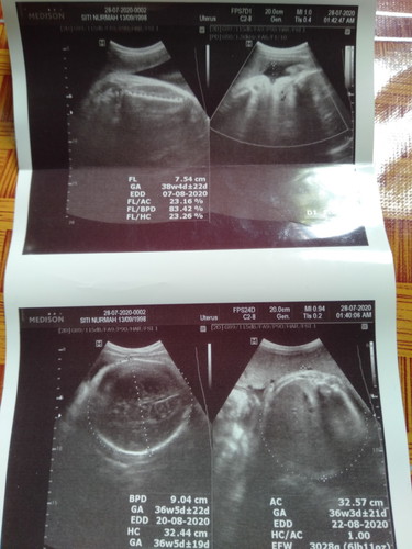 37-38w
