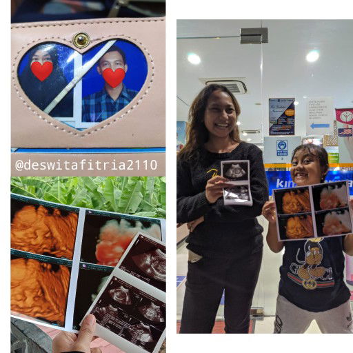 Ade Fitria (Mama kirei) profile icon