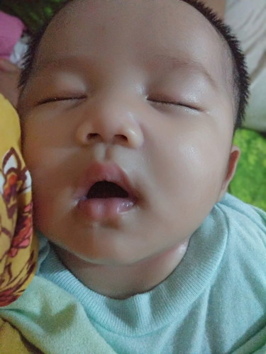 Hidung Mampet