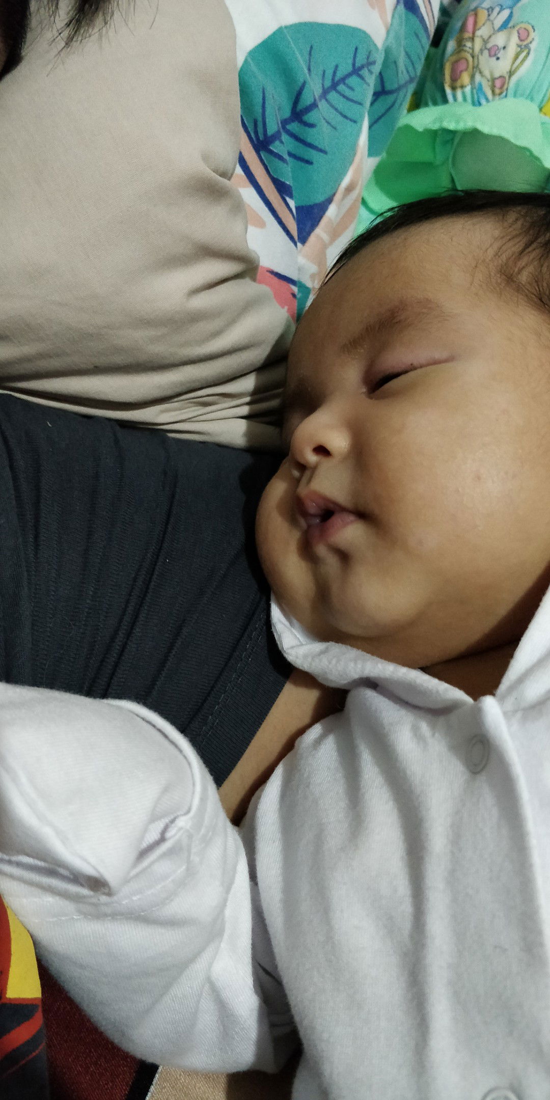 White spots sa face ni baby