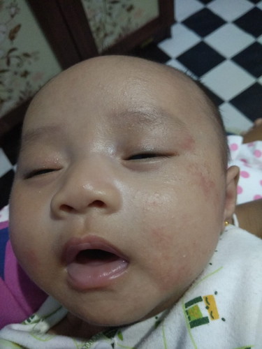 wajah bayi merah