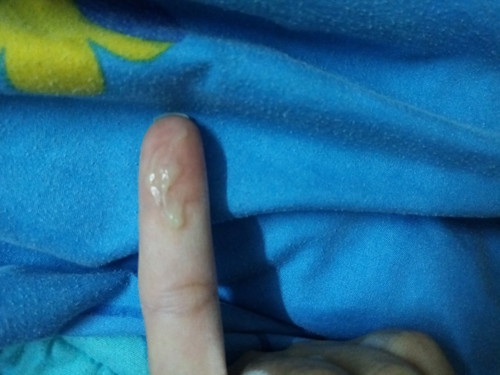 อีกแล้วค่ะ🥺