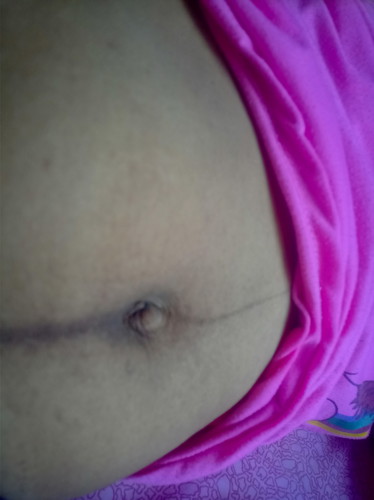 perut setelah melahirkan