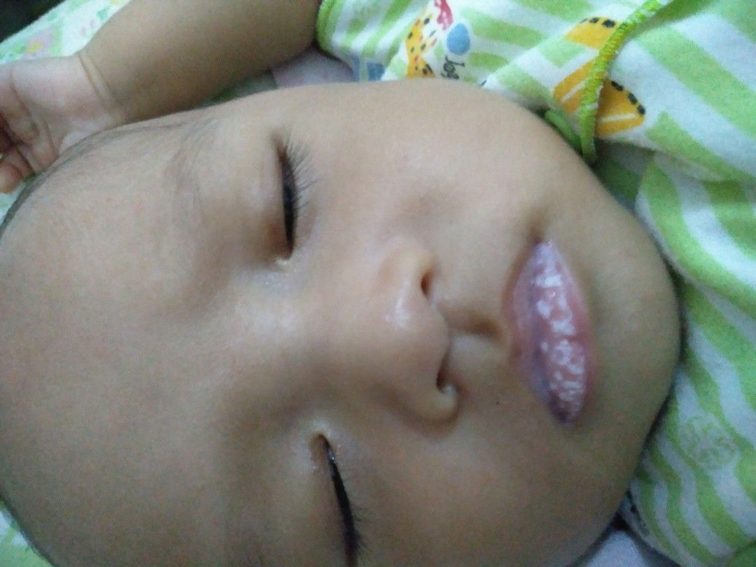 bibir bayi