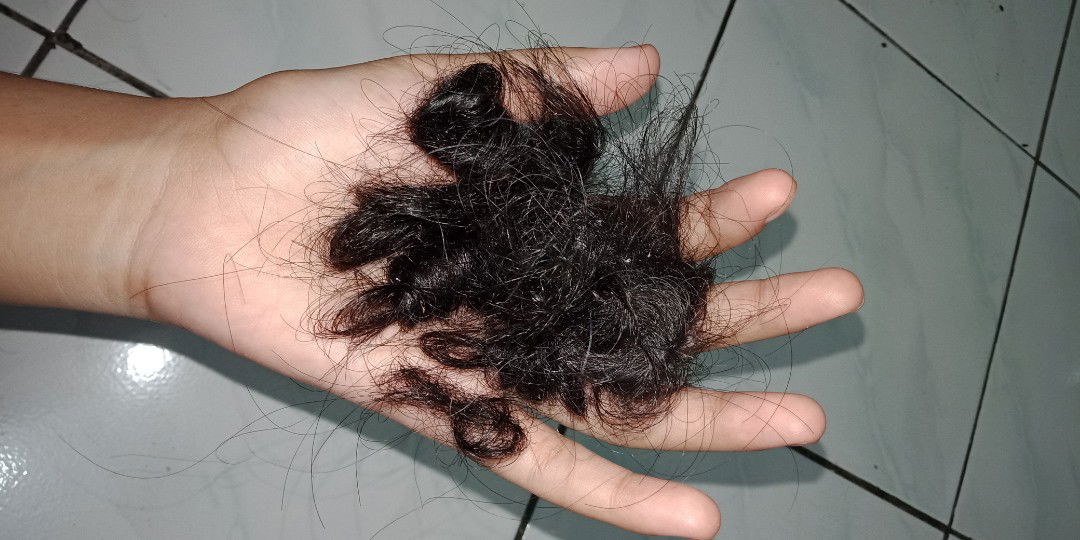 rambut rontok