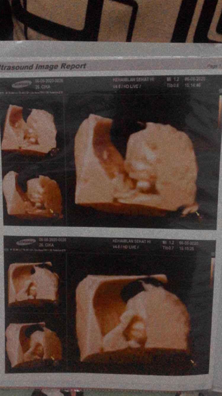 Cika Rostika profile icon