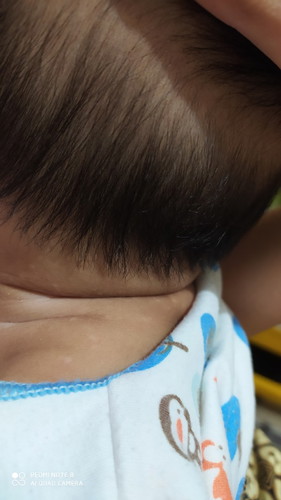 Obat apa ya bun buat anak ku ini