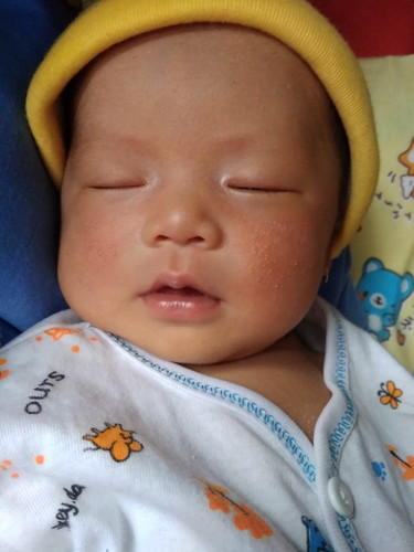 kulit bayi umur 9 hari