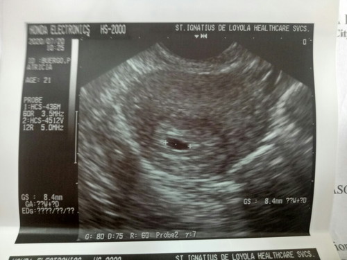 less than 4 weeks.