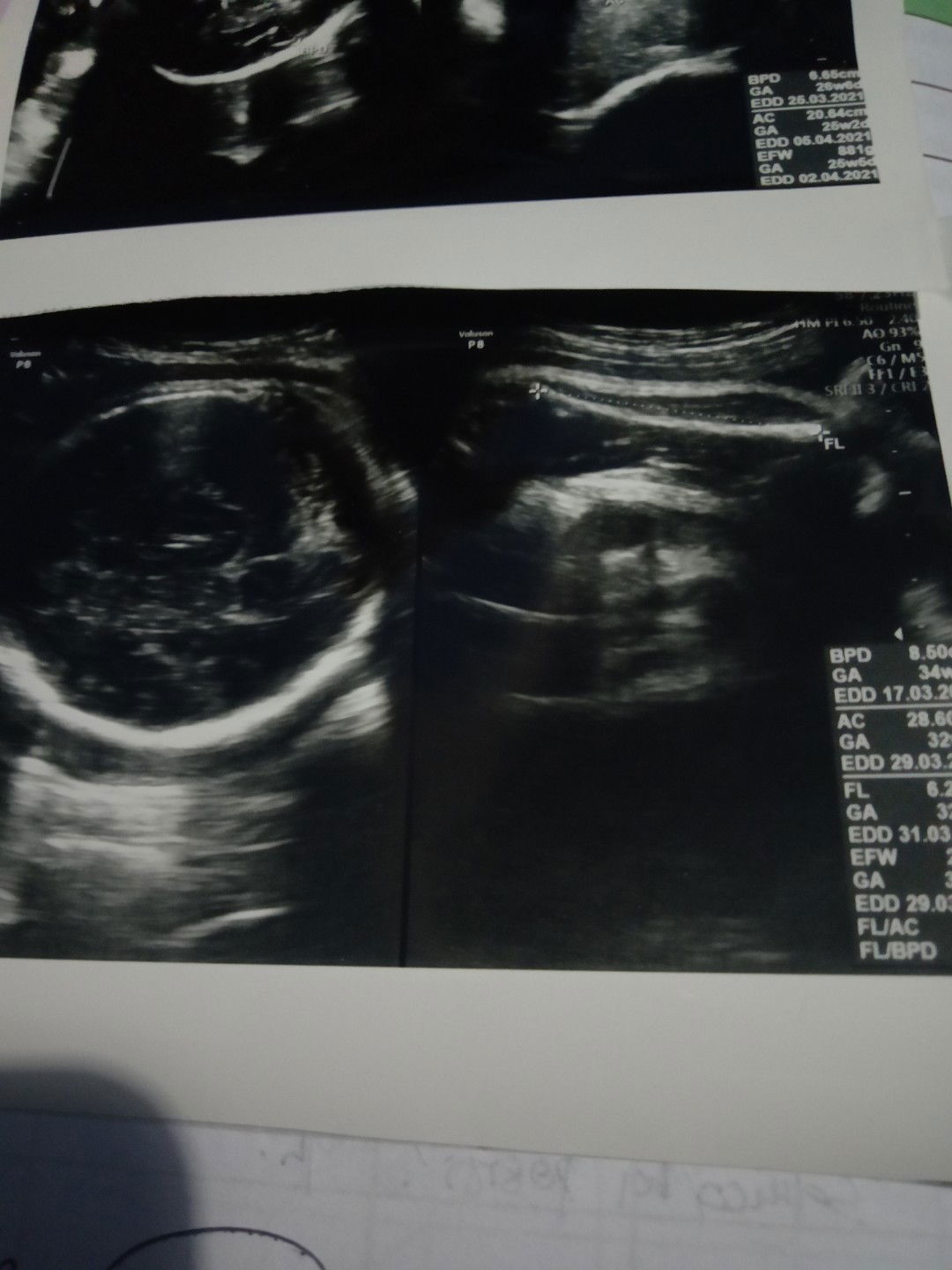 Pengalaman USG dokter dan priksa bidan