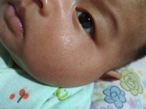 Kulit Bayi