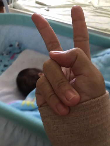 ข้อมือเคล็ด