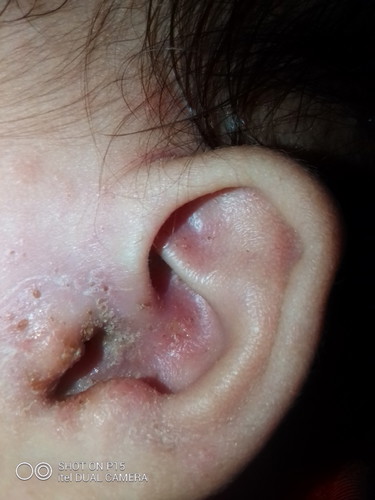 ears
