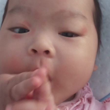 คัยรุบ้างคะว่าน้องเป็นอะไร