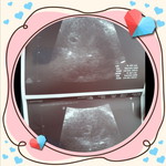 Baiyok profile icon