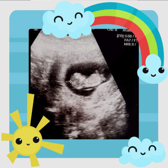 ไมค์ เซอร์ profile icon